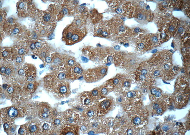 Immunohistochemistry of paraffin-embedded human liver tissue slide using Catalog No:112507(MBL2 Antibody) at dilution of 1:50 (under 40x lens)