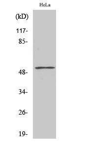 Fig1:; Western Blot analysis of various cells using PFK-2 liv/tes Polyclonal Antibody