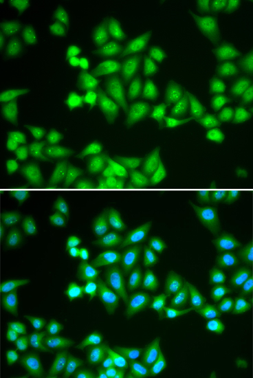 Immunofluorescence - CHD2 Polyclonal Antibody 
