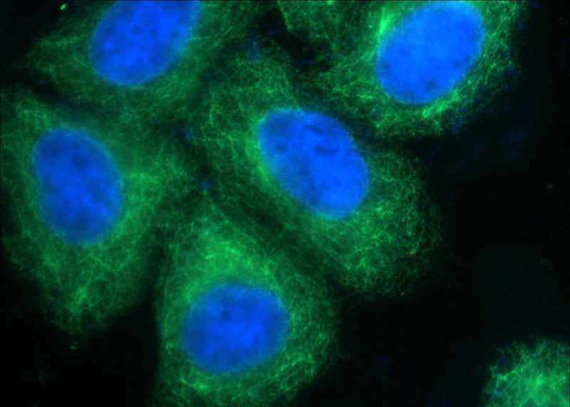 Immunofluorescent analysis of MCF-7 cells using Catalog No:109813(KRT8 Antibody) at dilution of 1:25 and Alexa Fluor 488-congugated AffiniPure Goat Anti-Rabbit IgG(H+L)