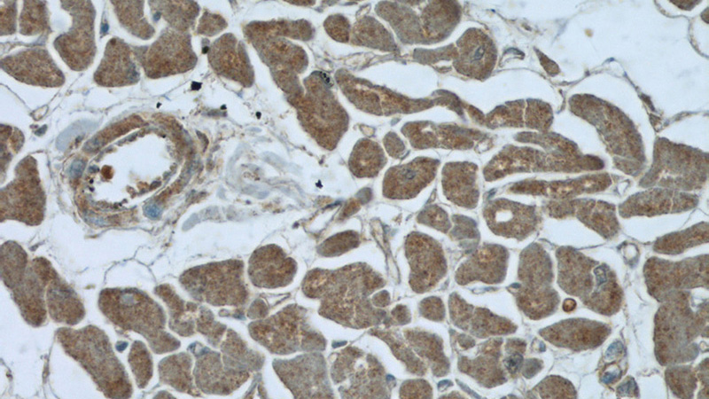 Immunohistochemistry of paraffin-embedded human heart tissue slide using Catalog No:116624(UPB1 Antibody) at dilution of 1:50 (under 40x lens)