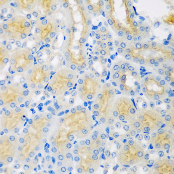 Immunohistochemistry - CYP4A11 Polyclonal Antibody 