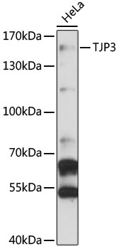 Western blot - TJP3 Polyclonal Antibody 
