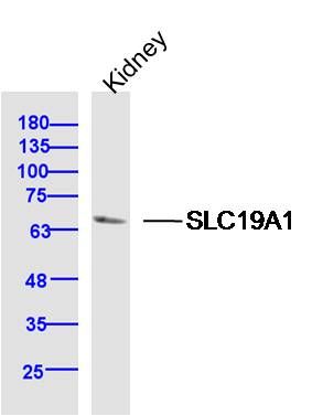 Fig1: Sample: Kidney (Mouse) Lysate at 40 ug; Primary: Anti-SLC19A1 at 1/300 dilution; Secondary: IRDye800CW Goat Anti-Rabbit IgG at 1/20000 dilution; Predicted band size: 64 kD; Observed band size: 64 kD