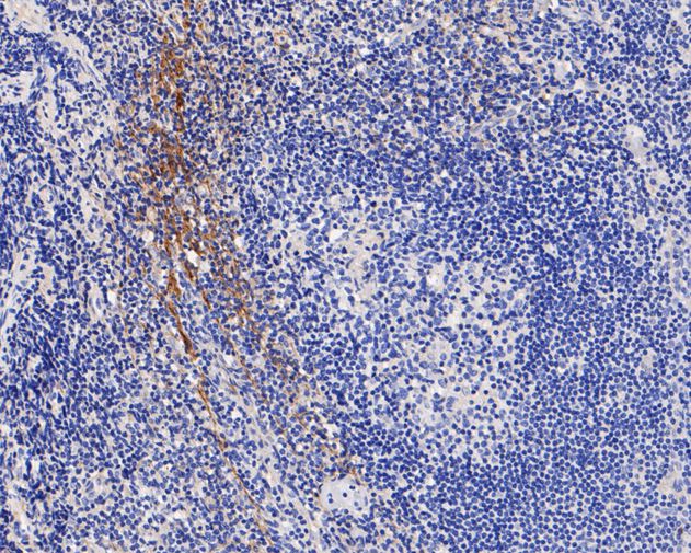 Fig1:; Immunohistochemical analysis of paraffin-embedded human tonsil tissue using anti-Tenascin C antibody. The section was pre-treated using heat mediated antigen retrieval with Tris-EDTA buffer (pH 8.0-8.4) for 20 minutes.The tissues were blocked in 5% BSA for 30 minutes at room temperature, washed with ddH; 2; O and PBS, and then probed with the primary antibody ( 1/50) for 30 minutes at room temperature. The detection was performed using an HRP conjugated compact polymer system. DAB was used as the chromogen. Tissues were counterstained with hematoxylin and mounted with DPX.