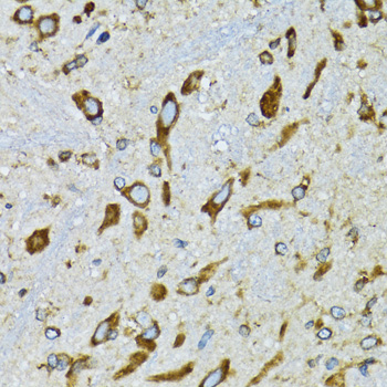 Immunohistochemistry - RPN1 Polyclonal Antibody 