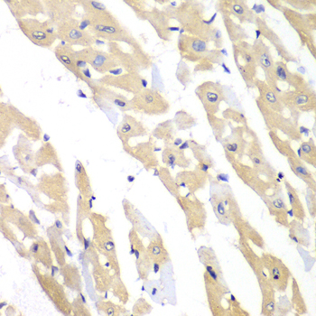Immunohistochemistry - CCT3 Polyclonal Antibody 