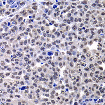 Immunohistochemistry - mH2A1 Polyclonal Antibody 