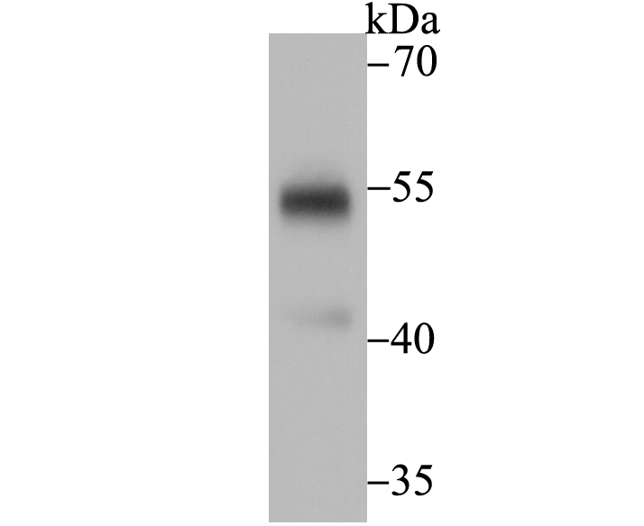 Fig1: Western blot analysis of UGP2 on human liver tissue lysate using anti-UGP2 antibody at 1/200 dilution.