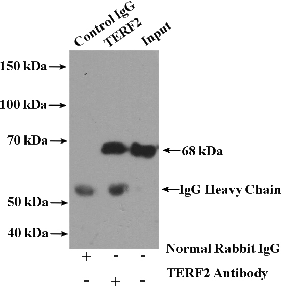 IP Result of anti-TERF2 (IP:Catalog No:115947, 4ug; Detection:Catalog No:115947 1:500) with K-562 cells lysate 4000ug.