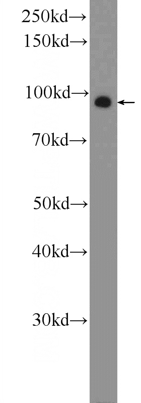 A549 cells were subjected to SDS PAGE followed by western blot with Catalog No:117156(ZNF287 Antibody) at dilution of 1:300