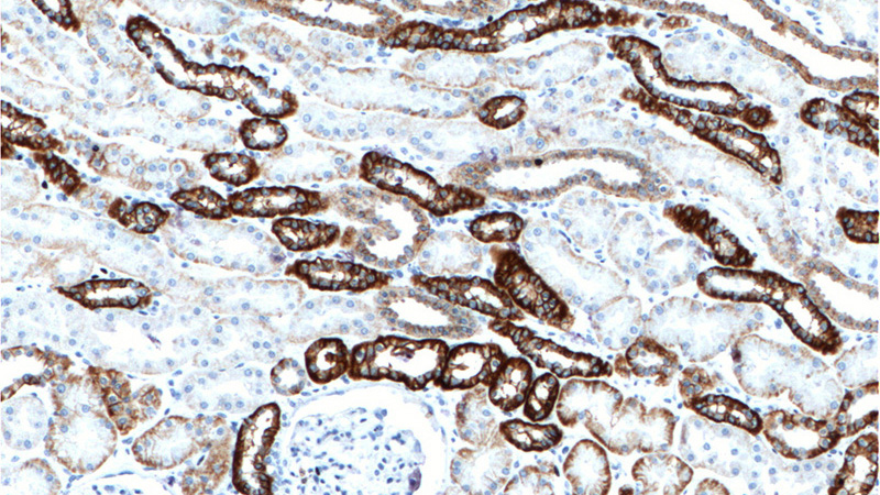 Immunohistochemistry of paraffin-embedded human kidney tissue slide using Catalog No:108773(CDH16 Antibody) at dilution of 1:200 (under 10x lens).