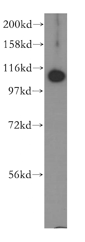human placenta tissue were subjected to SDS PAGE followed by western blot with Catalog No:112916(MYCBPAP antibody) at dilution of 1:300
