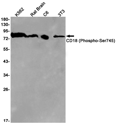 Western blot detection of CD18 (Phospho-Ser745) in K562,Rat Brain,C6,3T3 cell lysates using CD18 (Phospho-Ser745) Rabbit pAb(1:1000 diluted).Predicted band size:85kDa.Observed band size:85kDa.