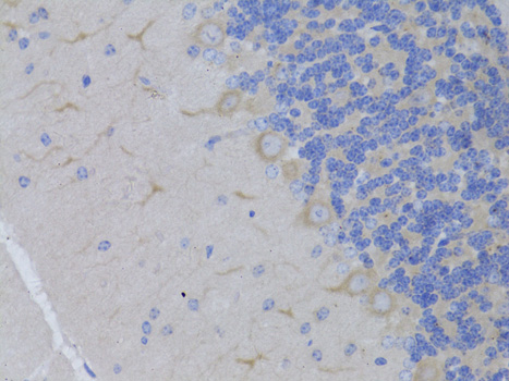Immunohistochemistry - RARA Polyclonal Antibody 