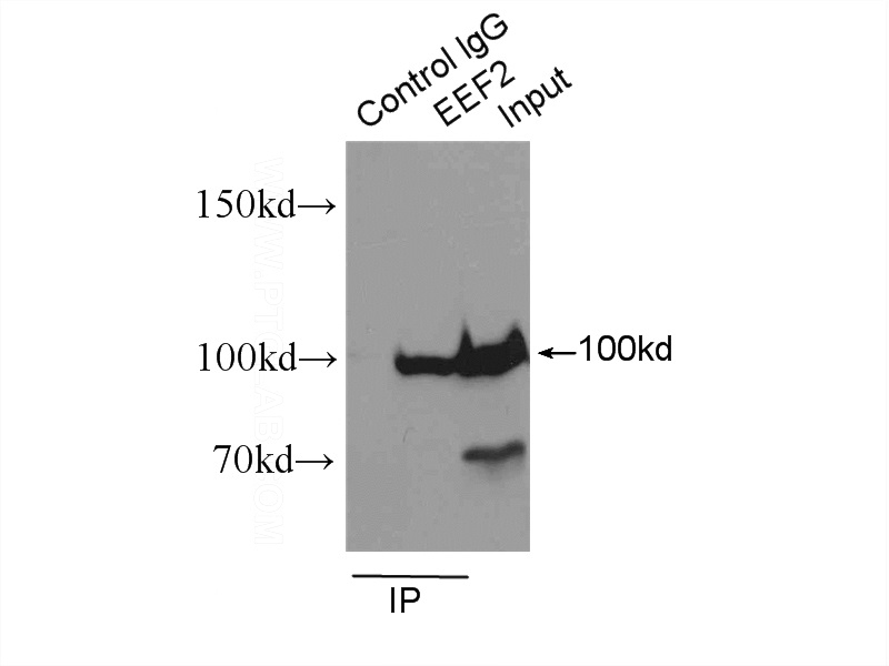 IP Result of anti-EEF2 (IP:Catalog No:110316, 3ug; Detection:Catalog No:110316 1:500) with HeLa cells lysate 1600ug.
