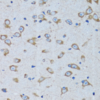 Immunohistochemistry - RARS Polyclonal Antibody 