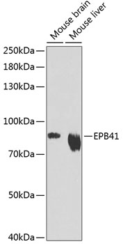 Western blot - EPB41 Polyclonal Antibody 
