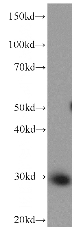 HeLa cells were subjected to SDS PAGE followed by western blot with Catalog No:107059(ANP32B Antibody) at dilution of 1:5000
