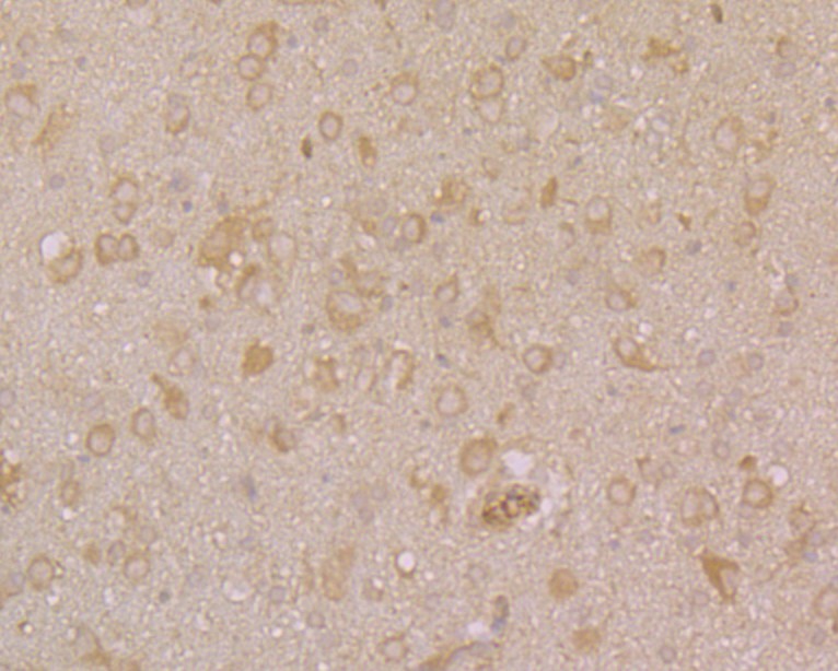 Fig5: Immunohistochemical analysis of paraffin-embedded rat brain tissue using anti-PHF8 antibody. Counter stained with hematoxylin.