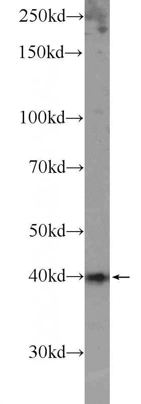 mouse testis tissue were subjected to SDS PAGE followed by western blot with Catalog No:115510(SOX12 Antibody) at dilution of 1:1000