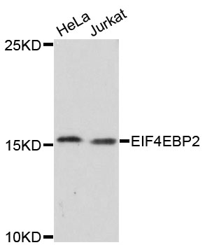 Western blot - EIF4EBP2 Polyclonal Antibody 