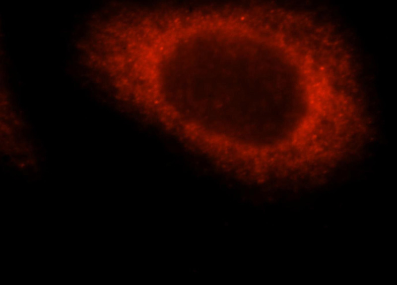 Immunofluorescent analysis of MCF-7 cells, using CEP70 antibody Catalog No:109185 at 1:25 dilution and Rhodamine-labeled goat anti-rabbit IgG (red).