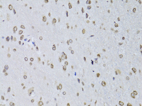 Immunohistochemistry - LMNB2 Polyclonal Antibody 
