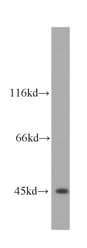 COLO 320 cells were subjected to SDS PAGE followed by western blot with Catalog No:107083(BCS1L antibody) at dilution of 1:1000