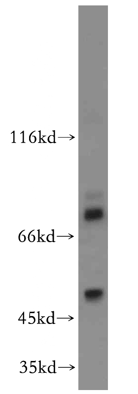 MCF7 cells were subjected to SDS PAGE followed by western blot with Catalog No:110745(FOXA1 antibody) at dilution of 1:200