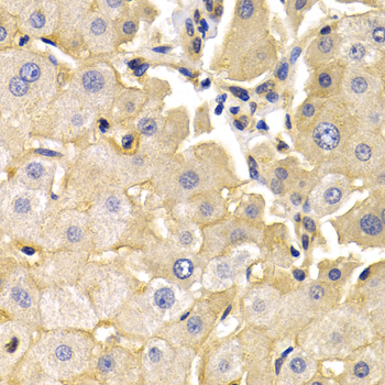 Immunohistochemistry - KLKB1 Polyclonal Antibody 