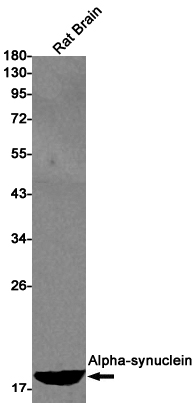 Western blot detection of Alpha-synuclein in Rat Brain lysates using Alpha-synuclein Rabbit pAb(1:1000 diluted).Predicted band size:15kDa.Observed band size:18kDa.