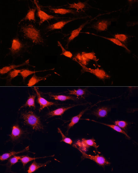 Immunofluorescence - PGC1 alpha Polyclonal Antibody 