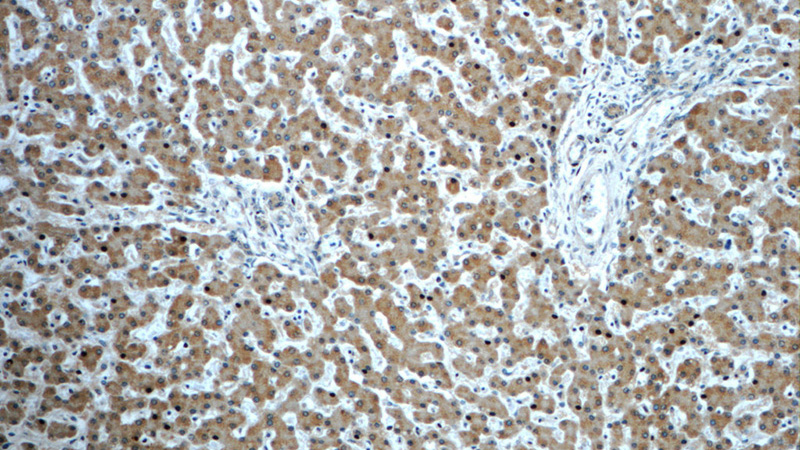 Immunohistochemistry of paraffin-embedded human liver slide using Catalog No:107303(GOSR2 Antibody) at dilution of 1:50