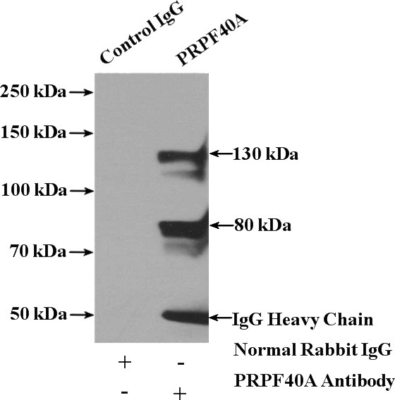 IP Result of anti-PRPF40A (IP:Catalog No:114232, 4ug; Detection:Catalog No:114232 1:500) with HEK-293 cells lysate 3000ug.
