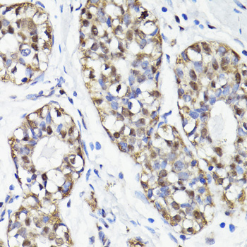 Immunohistochemistry - NAV2 Polyclonal Antibody 