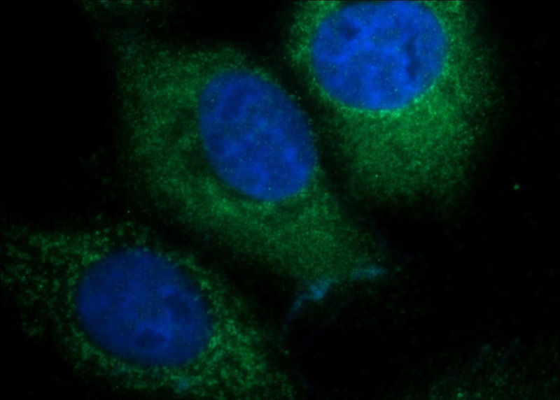 Immunofluorescent analysis of A431 cells using Catalog No:109888(DENND1A Antibody) at dilution of 1:25 and Alexa Fluor 488-congugated AffiniPure Goat Anti-Rabbit IgG(H+L)