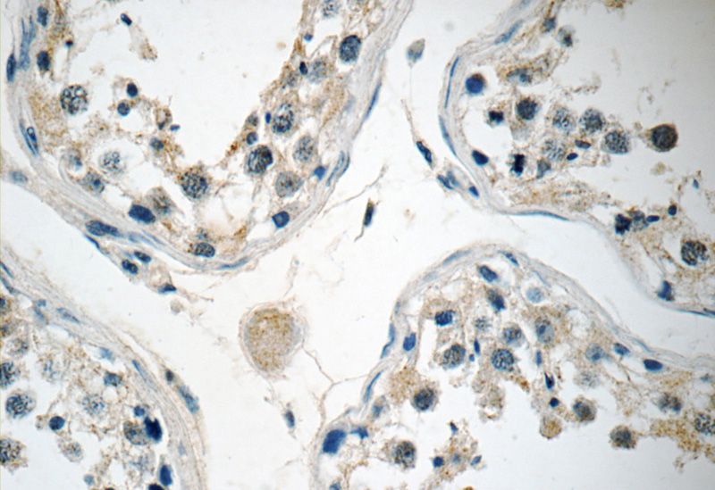 Immunohistochemistry of paraffin-embedded human testis tissue slide using Catalog No:112085(KLHDC3 Antibody) at dilution of 1:50 (under 40x lens)