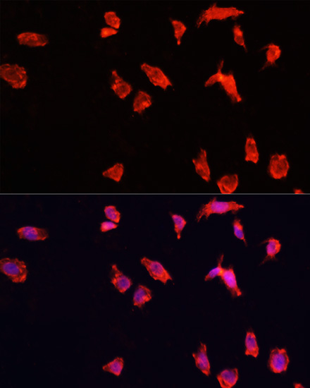 Immunofluorescence - ATP6V1B2 Polyclonal Antibody 