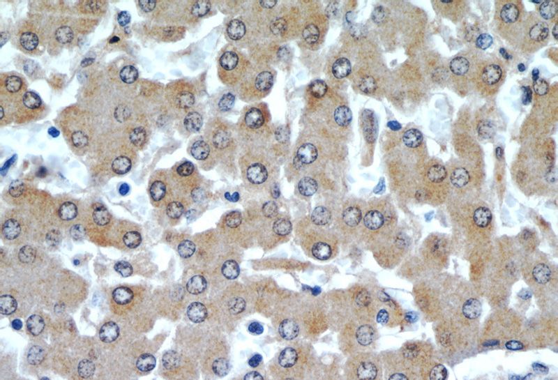 Immunohistochemical of paraffin-embedded human liver using Catalog No:108196(ARL13B antibody) at dilution of 1:50 (under 40x lens)