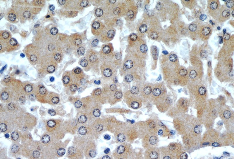Immunohistochemical of paraffin-embedded human liver using Catalog No:108196(ARL13B antibody) at dilution of 1:50 (under 40x lens)