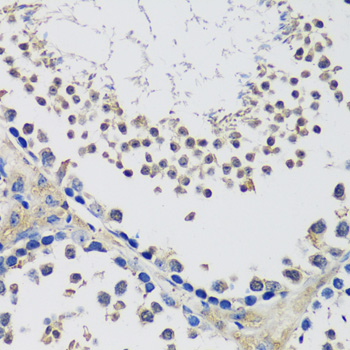 Immunohistochemistry - C10orf62 Polyclonal Antibody 