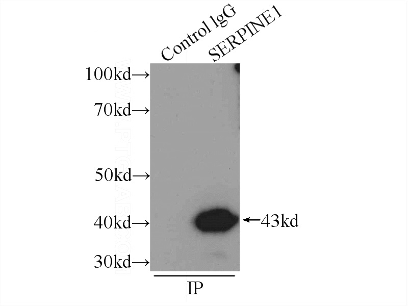 IP Result of anti-SERPINE1 (IP:Catalog No:113492, 3ug; Detection:Catalog No:113492 1:300) with SH-SY5Y cells lysate 2000ug.