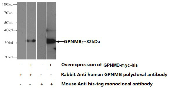 Transfected HEK-293 cells were subjected to SDS PAGE followed by western blot with Catalog No:111068(GPNMB Antibody) at dilution of 1:1000