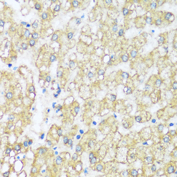 Immunohistochemistry - ATP5I Polyclonal Antibody 