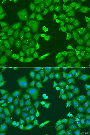 Immunofluorescence - CYP11B1 Polyclonal Antibody 