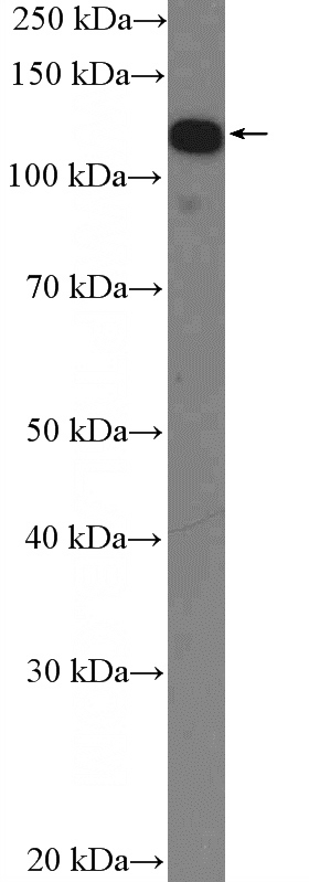 HeLa cells were subjected to SDS PAGE followed by western blot with Catalog No:111876(IWS1 Antibody) at dilution of 1:3000
