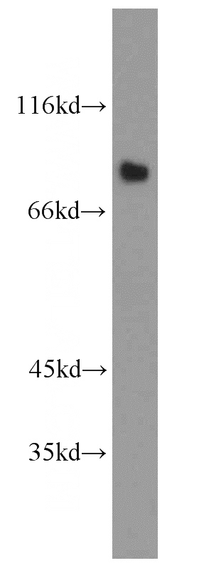 mouse brain tissue were subjected to SDS PAGE followed by western blot with Catalog No:112240(LINGO1 antibody) at dilution of 1:1500