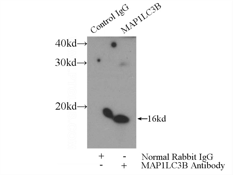 IP Result of anti-LC3 (IP:Catalog No:112164, 3ug; Detection:Catalog No:112164 1:1000) with mouse brain tissue lysate 4000ug.