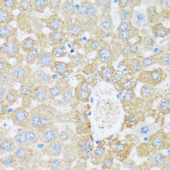 Immunohistochemistry - ARSB Polyclonal Antibody 